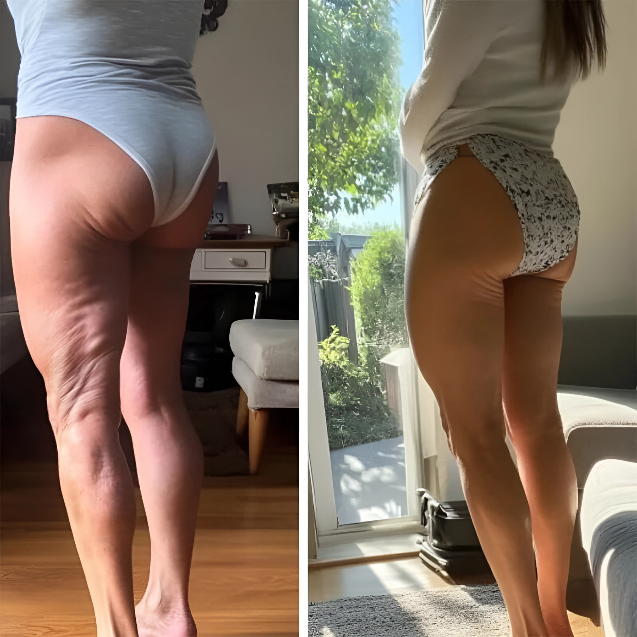 GlowCup Cellulite Remover & Toner