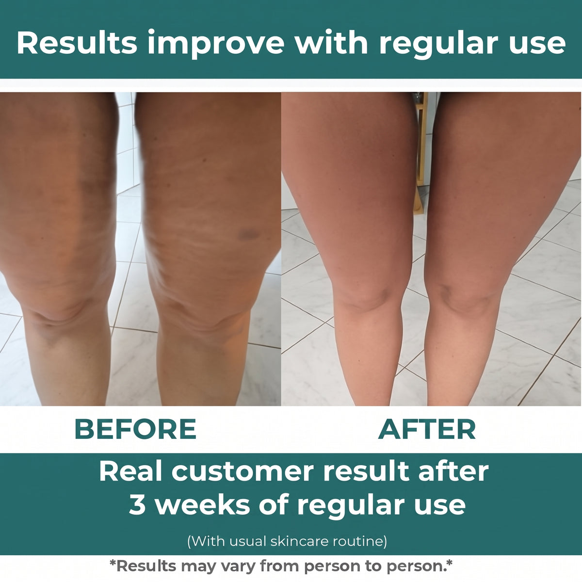 FirmFlex Pro - Leave The Cellulite Behind