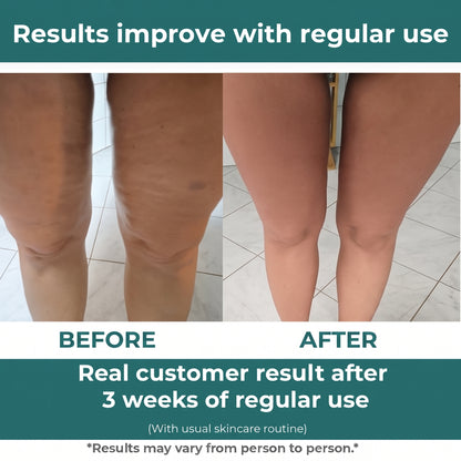 FirmFlex Pro - Leave The Cellulite Behind