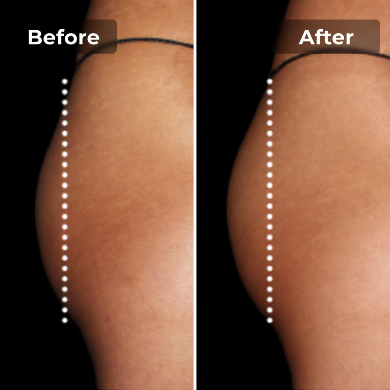 CoreLift EMS Toning Shorts