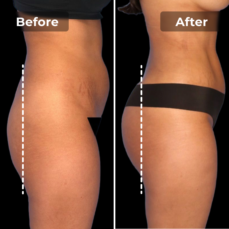 CoreLift EMS Toning Shorts