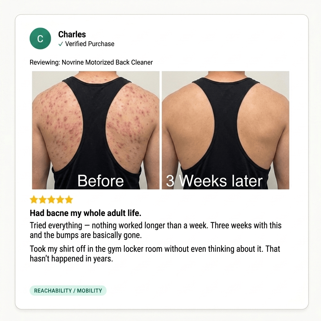 ClearReach Bacne Treatment