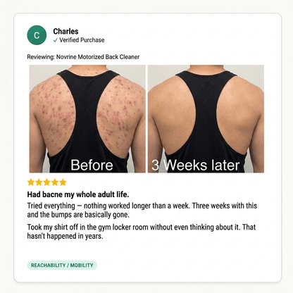 ClearReach Bacne Treatment