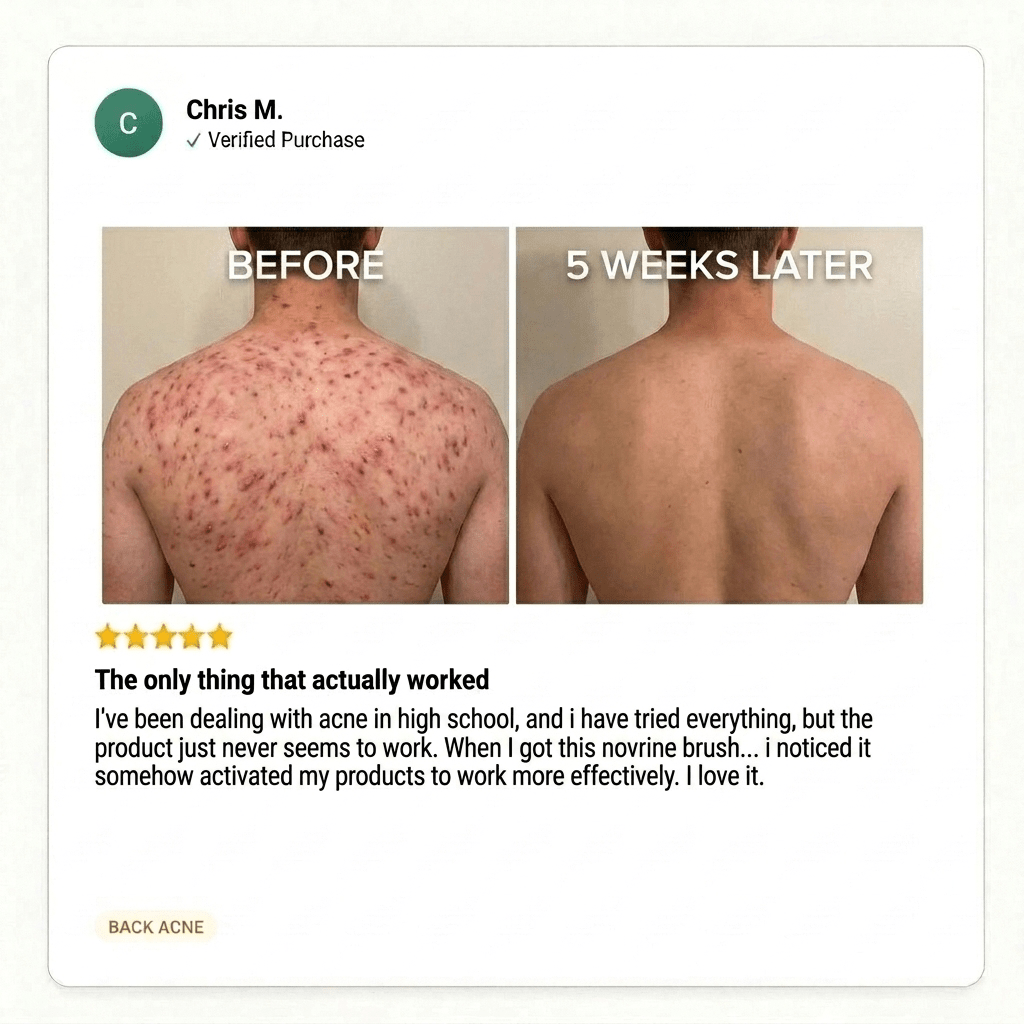 ClearReach Bacne Treatment