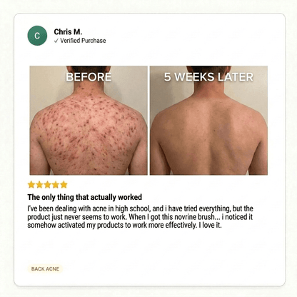 ClearReach Bacne Treatment