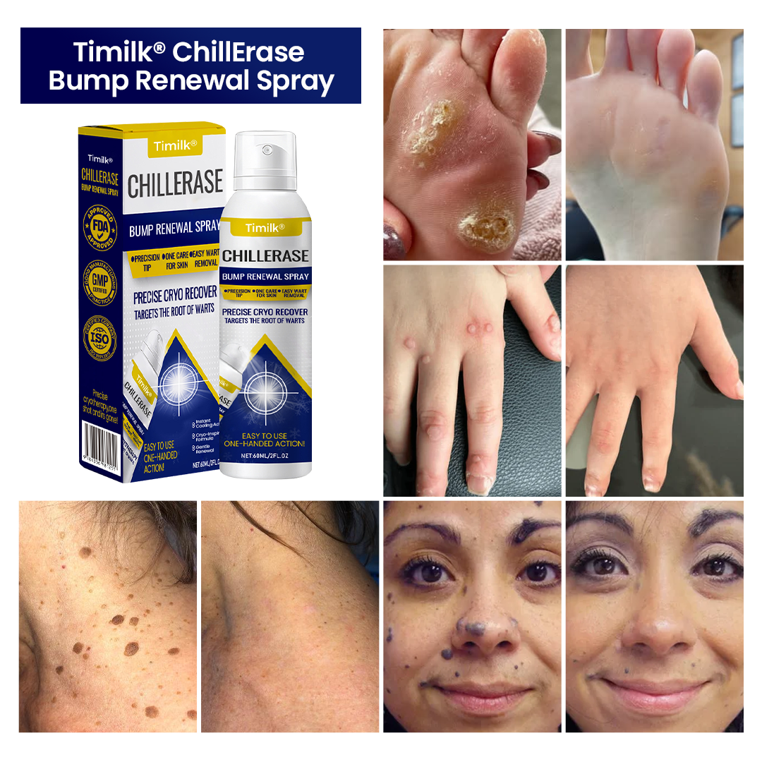 FrostMist™ — Chill Away Bumps and Unleash Silky, Touchable Skin Fast