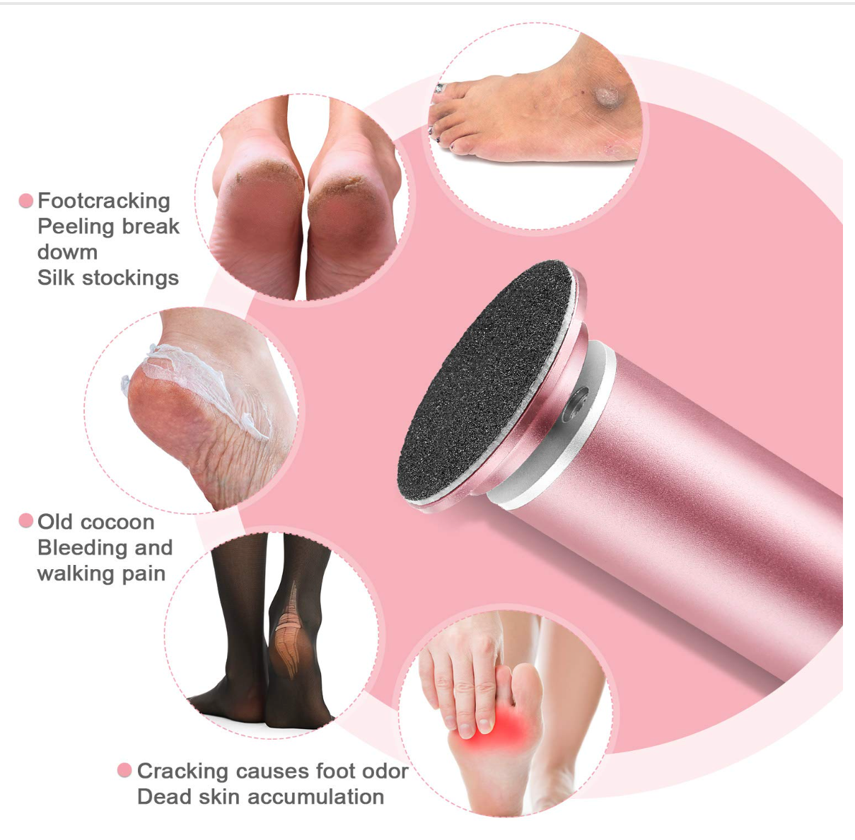 Omi Electric Callus Remover