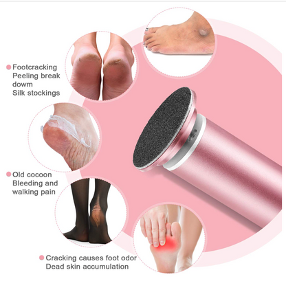 Omi Electric Callus Remover