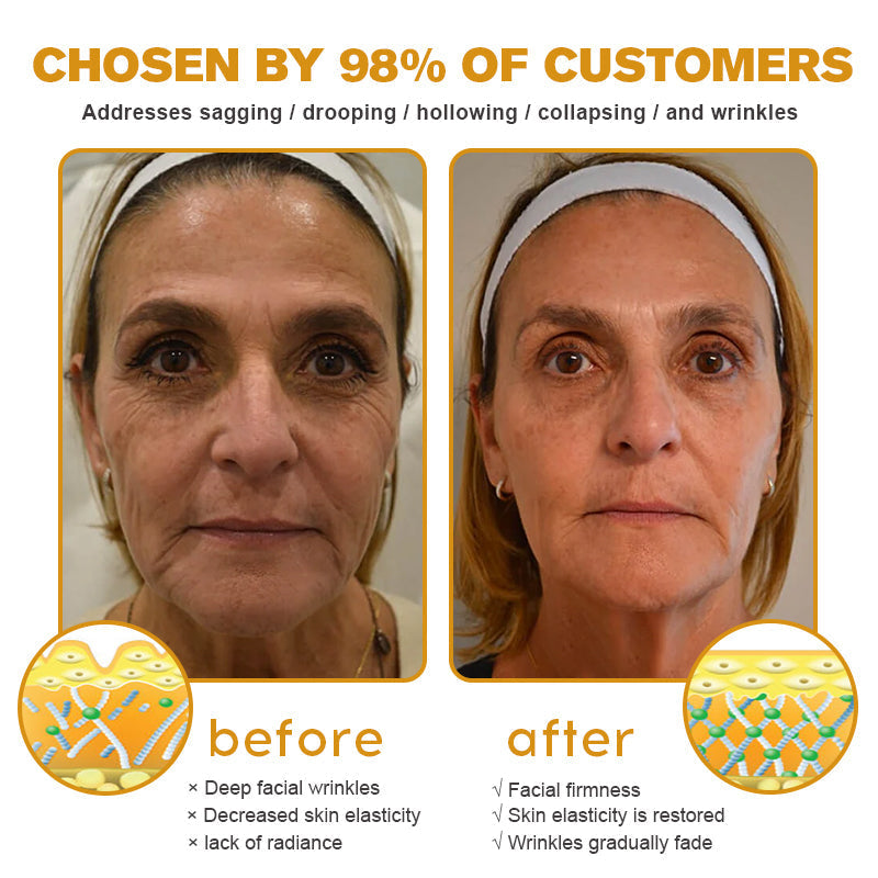 YouthGlow Anti-Wrinkle Cream