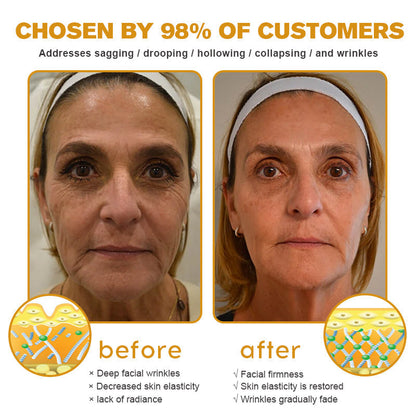 YouthGlow Anti-Wrinkle Cream