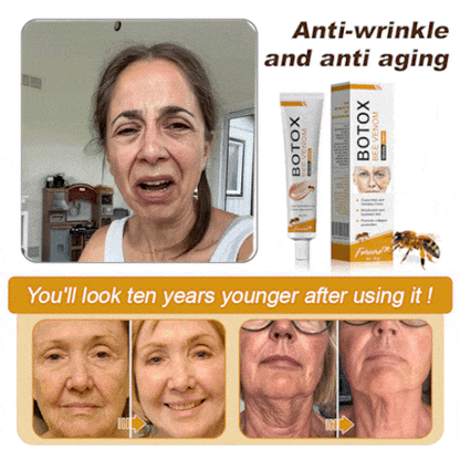 YouthGlow Anti-Wrinkle Cream