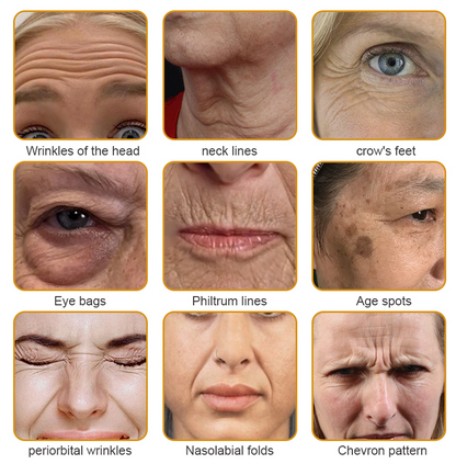 YouthGlow Anti-Wrinkle Cream