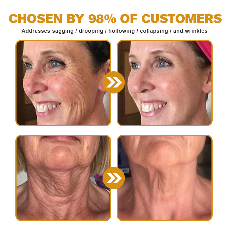 YouthGlow Anti-Wrinkle Cream