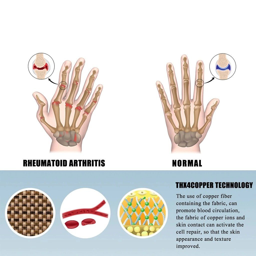 FlexRelief Gloves