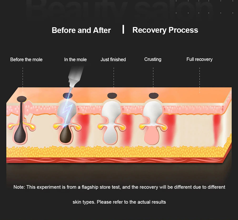 ClearLift Plasma Therapy Kit