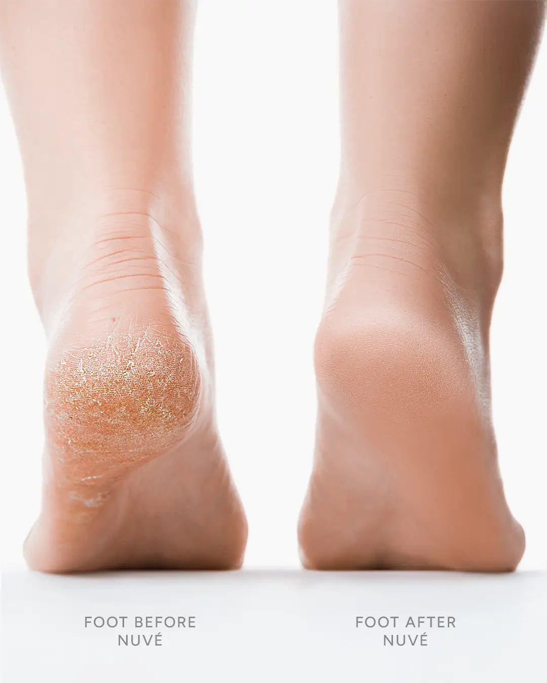 Silk 3 Pro Foot Care