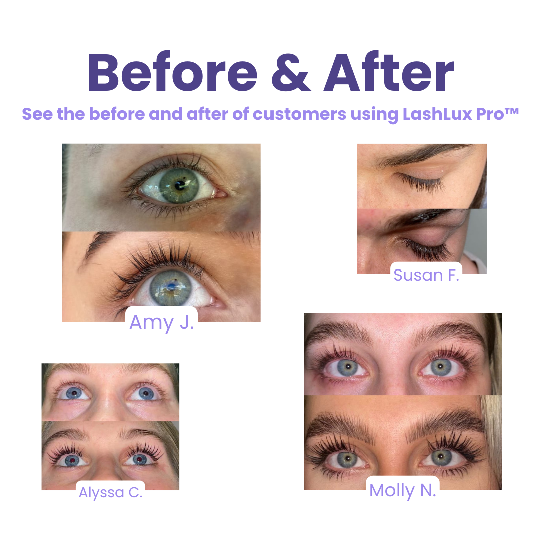 LashLux Pro Growth Serum - 1+1 FREE!