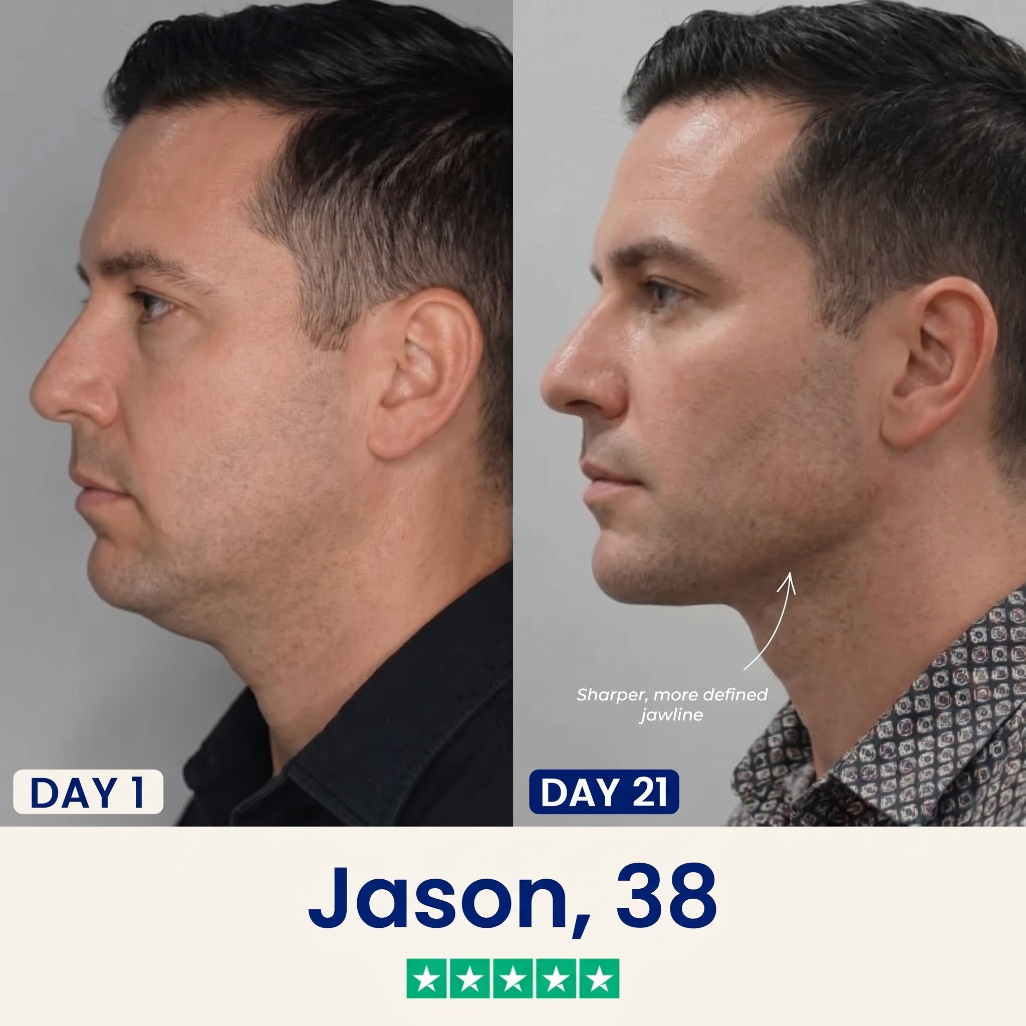 Jawline Sculptor Device