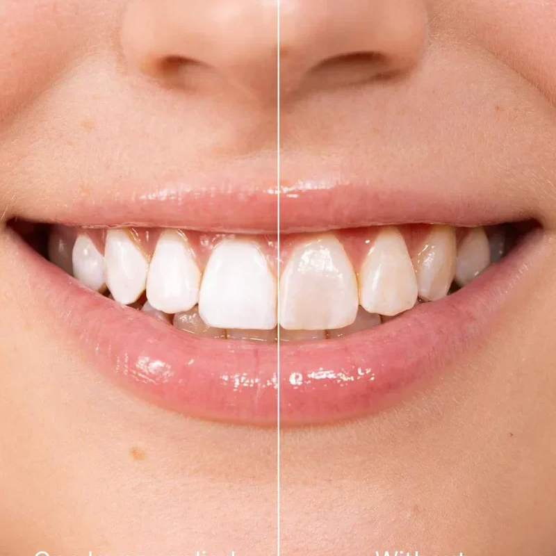 GlowTeeth Instant Whitening Paint | GET 1 FREE🔥