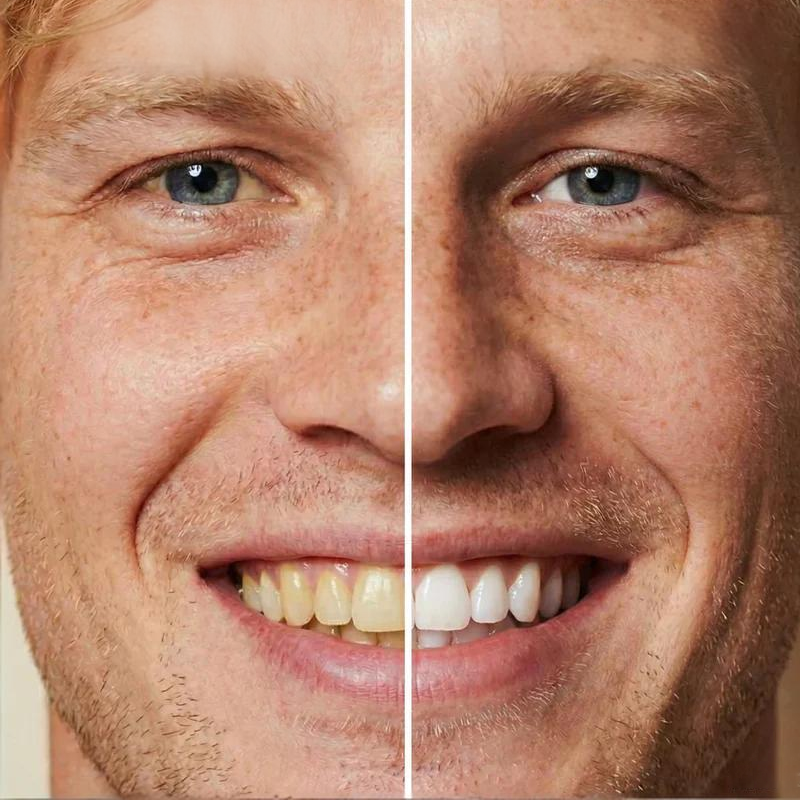 GlowTeeth Instant Whitening Paint | GET 1 FREE🔥